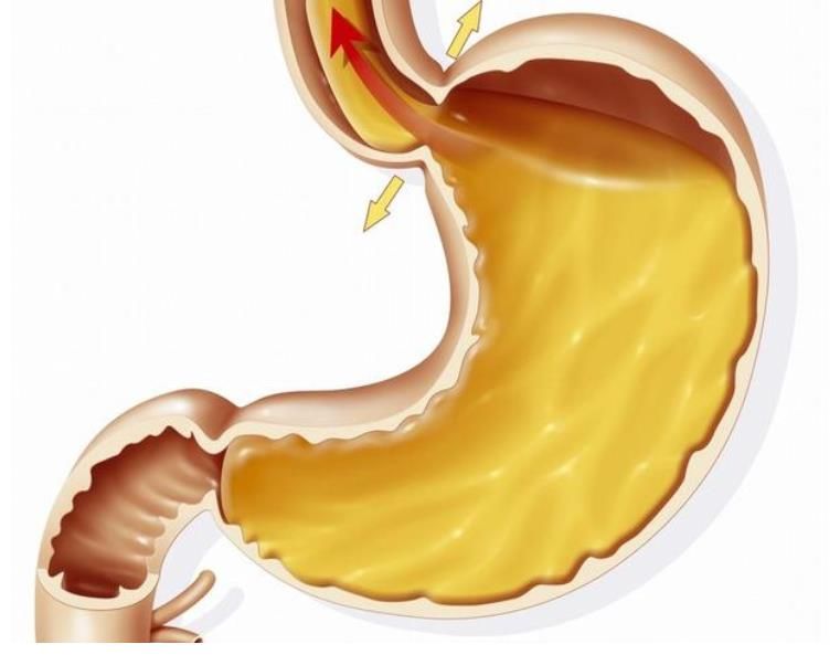 饮食|胃不好不能吃“红薯”？提示：养胃始于饮食，这3物，胃不好可常吃