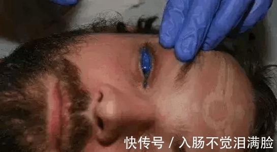 右眼处|直击: 全世界最恐怖的5双“变异”人眼,他的眼会抽烟
