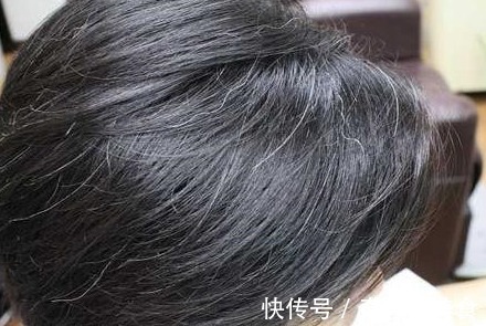 健康|长白头发,对我们健康来说是一件好事吗?听听哈佛大学研究怎么说