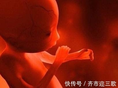 寄生胎|四岁男童肚子很大,刚开始以为是肿瘤,真相吓坏所有人!