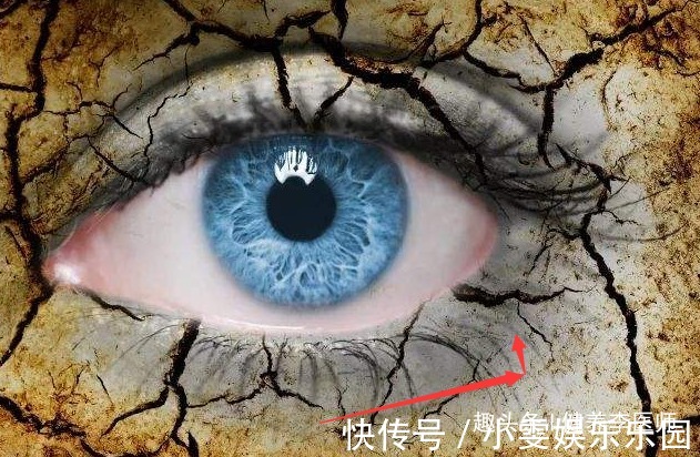 肝功能受损|“肝不干净”,眼睛会“说话”,若有3种“迹象”,肝炎或已来袭