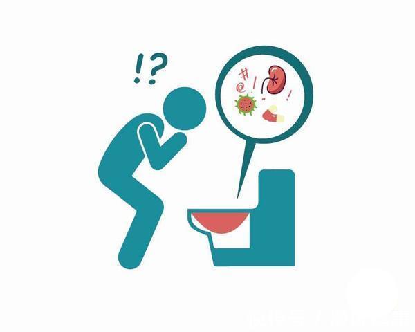 输尿管|膀胱癌,排尿知?患上膀胱癌的人,上厕所常常有这4个共同点