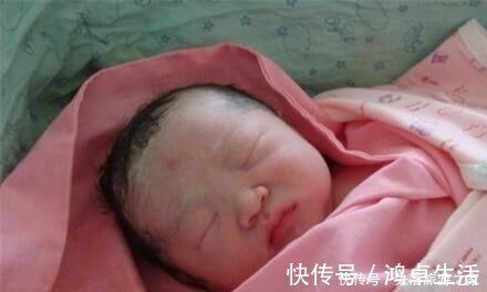 视力|宝宝出生时,有的睁开眼,有的闭上眼,哪种比较好医生说都好