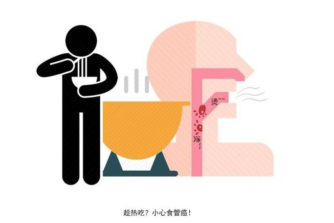 胃溃疡|吃饭喜欢做这3件事的人,不容易长寿,若你没有,值得高兴