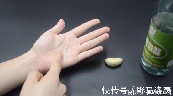 白醋倒在手心搓一搓,真的厉害了,解决了很多人的困扰