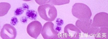 淋巴细胞|血常规，能不能检查出癌症提醒4个指标有异常，要做详细检查