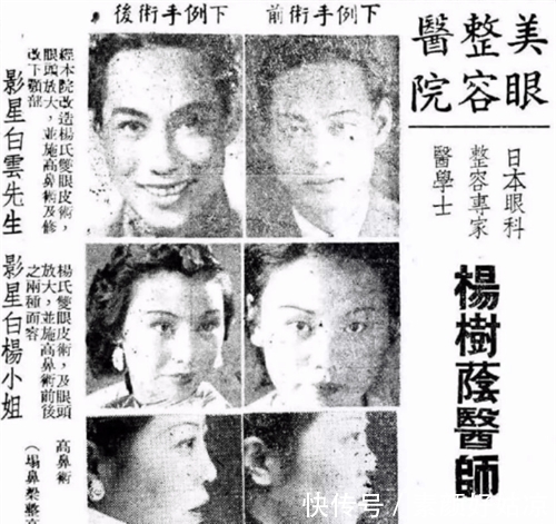 人造美女@林徽因真是人造美女?钱钟书讲述林徽因整容往事,不只是做过酒窝