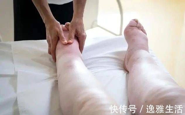 血糖|糖尿病者，身体出现4种表现，或是尿毒症“找上门”，莫忽视