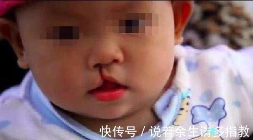 妈妈故意弄丢6岁兔唇女儿,20年后在人海中相遇,如今悔不当初