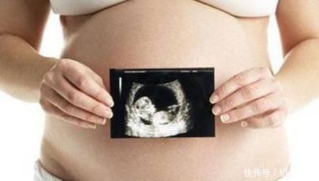 产检|产检被医生一个问题羞红了老脸!好尴尬啊!