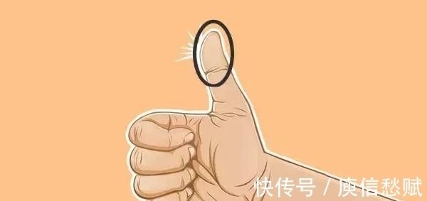 无糖食品|糖尿病每顿该吃多少?伸出手掌量一量!