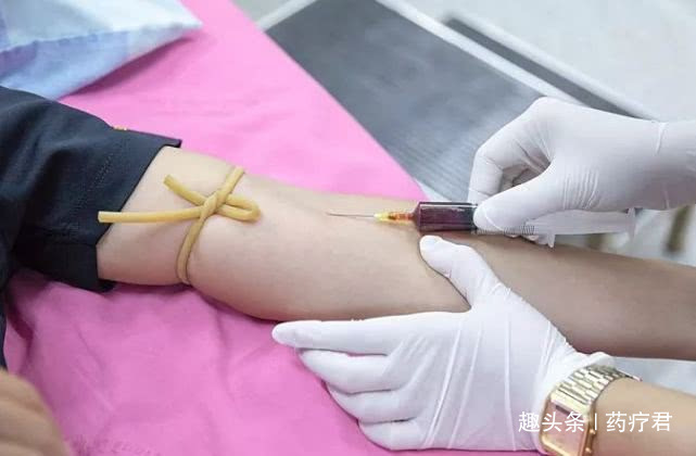 胆红素|肝功能正常，就没事了体检这些指标也正常，才能真的安心