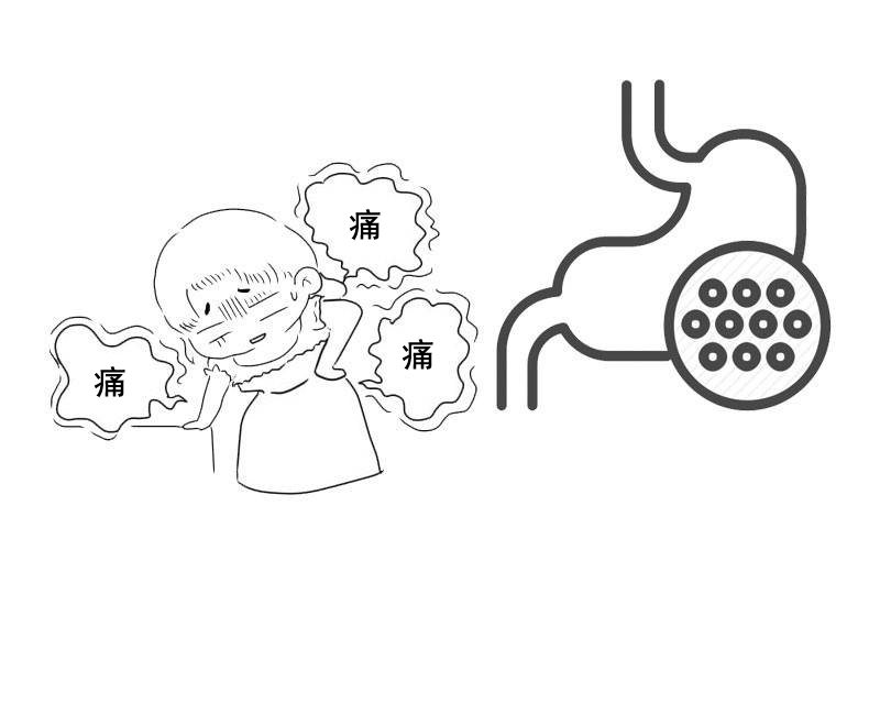 幽门螺杆菌感染|被美国列入明确致癌物?感染一半中国人的这种细菌,究竟有多厉害