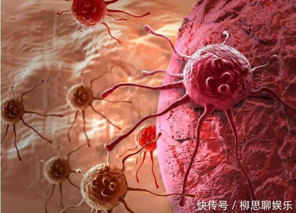 癌症患者若符合这3个条件,说明癌症治疗的不错,值得恭喜