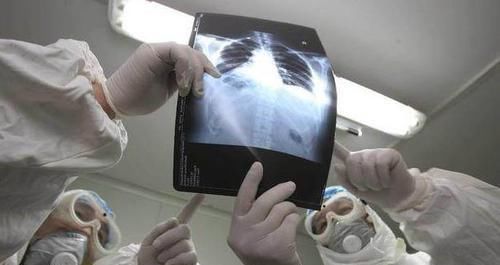 去世|55岁男子，体检正常5个月后查出晚期肺癌去世体检到底有何用