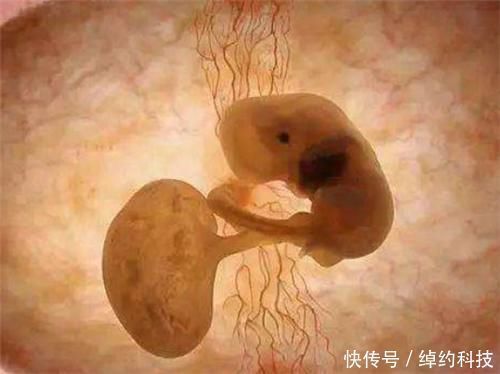 早产儿|18年了，那个出生仅280克的女婴，曾打破世界纪录，如今还活着