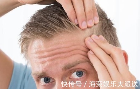 脱发|男性开始衰老时会6个表现,若一个不占,恭喜