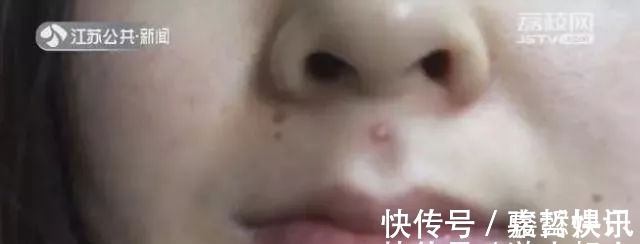 角质 小心!以下5个护肤坏习惯,能让你的毛孔越来越大……