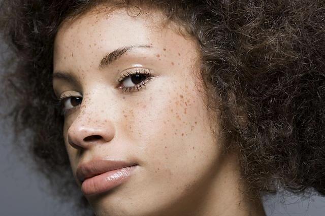 肌肤粗糙的原因是什么呢?有没有什么改善的方法?