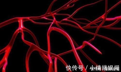 血管|血液垃圾的“死对头”, 早晚吃一点, 清理毒素, 血栓不来找