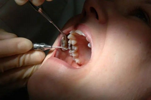 小伙|“我才30多岁啊!”杭州小伙张开嘴,医生一句话让他直掉泪:全都保不住了