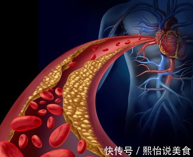 低热量|高血脂是吃出来的坚持“两低一高”饮食,2个月轻松吃掉高血脂