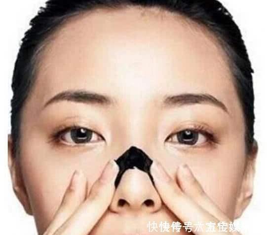 草莓鼻|想要解决鼻翼上的黑头牢记这几招,让你轻松告别“草莓鼻”