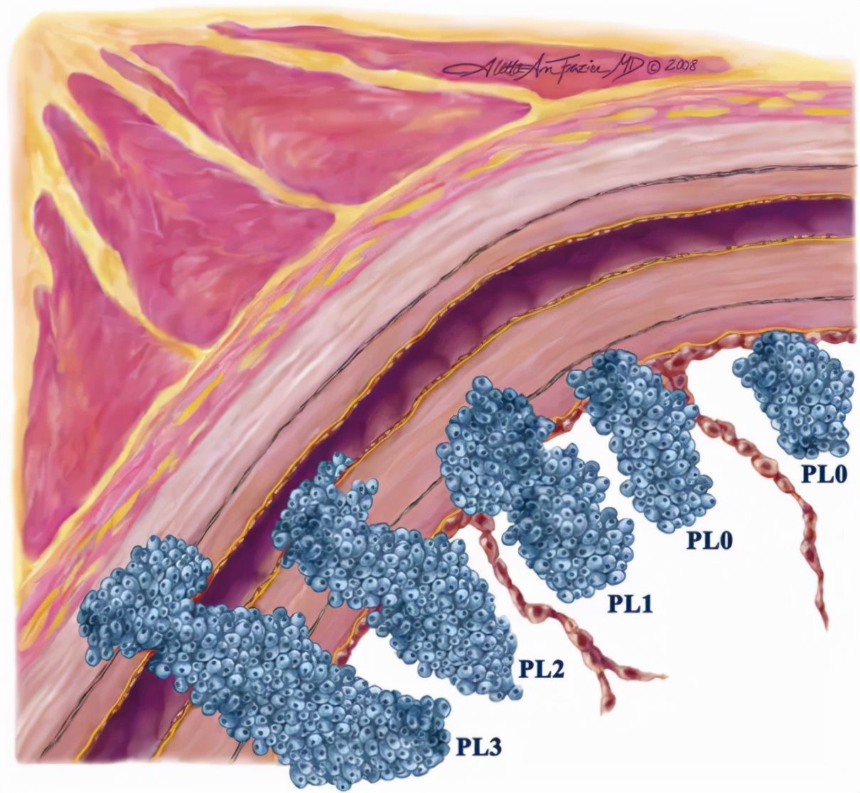 非小细胞肺癌|部分患者或可免去化疗!杨浩贤团队研究成果为早期肺癌患者带来福音