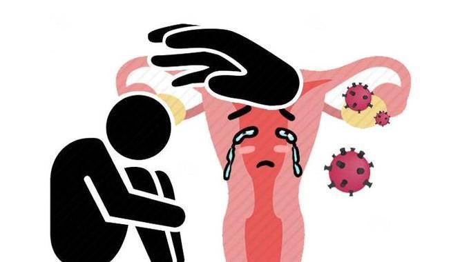 阴道|妇科检查查什么?没有性生活的女性,需要做妇科检查吗?