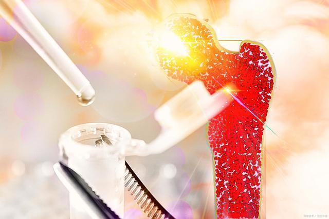 营养物质|吃芝麻有助抗骨疏松?转告家人:真正养骨的食物有3种,不妨常备