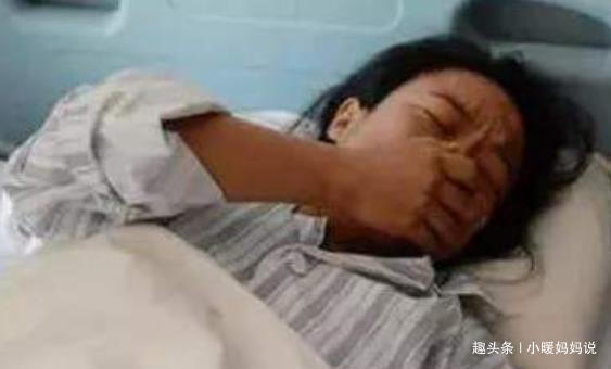 宝妈|孕妇十月怀胎,剖腹产2小时竟生出了“怪胎”,医生恭喜你