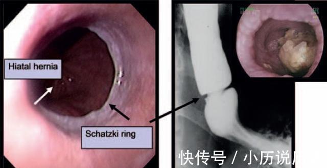 常见病|胸痛,却不是“心痛”,这些常见病你应该知道
