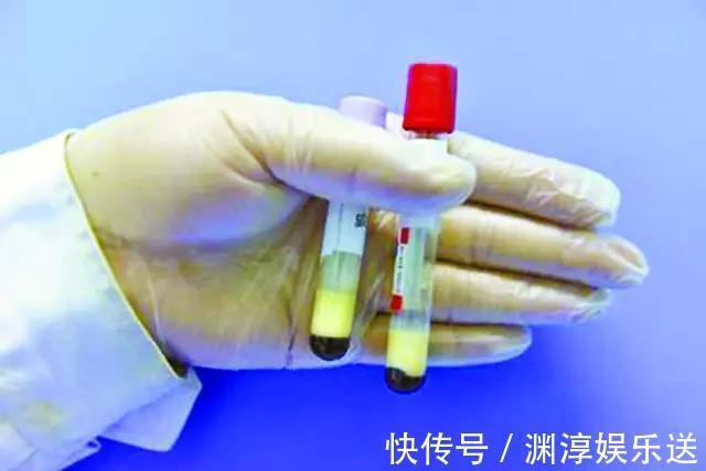 恢复|男子血脂10.8！仅2个月，血脂恢复正常！降血脂冠军是什么