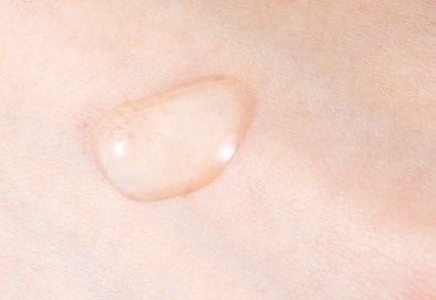 祛痘|测评:珂语产品到底好不好,痘痘肌使用怎么样