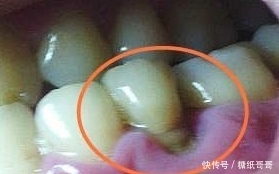 中药|关于有中药成分的牙膏,最近很多对话是酱样子的——