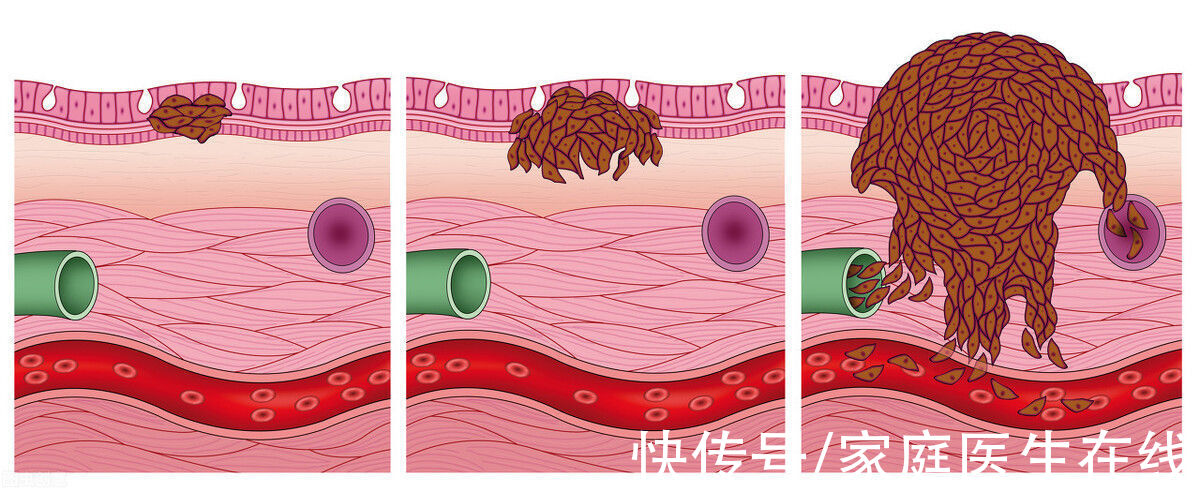 生存率|常说的“5年生存率”是怎回事？为何不是1年、3年？有依据的