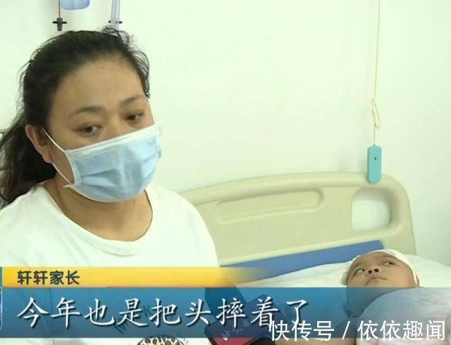癫痫|4岁女童头上的胎记,一查竟是血管瘤,医生给出了答案