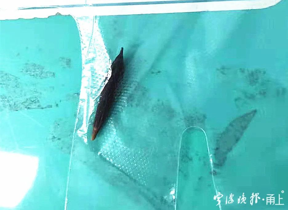 喝下一杯养生茶，宁波27岁小伙入院紧急手术！竟是因为这个动作