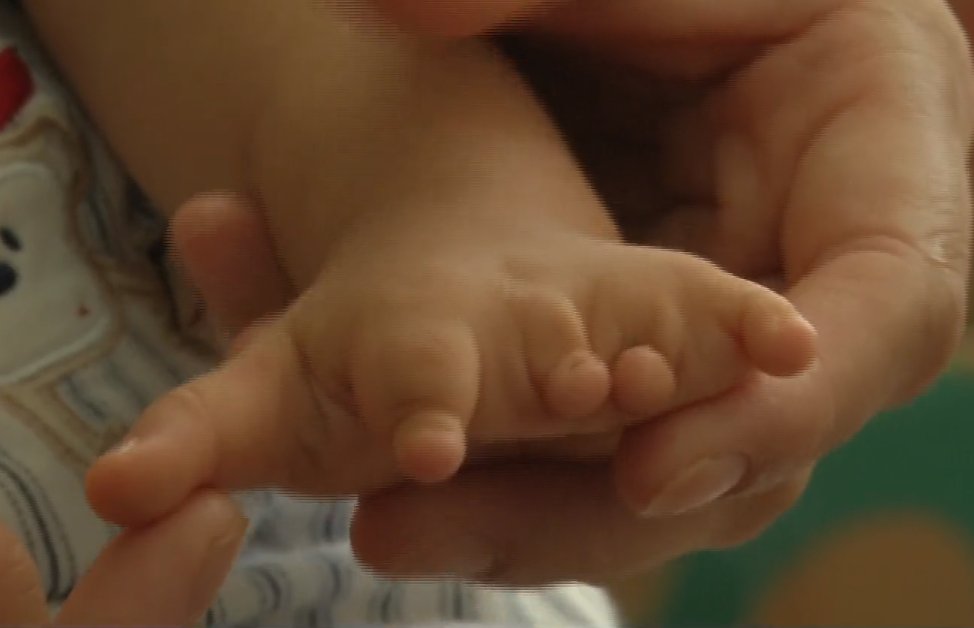 宝宝|宝宝出生缺失四根手指，家长质疑孕检误诊，涉事医院回复：不存在