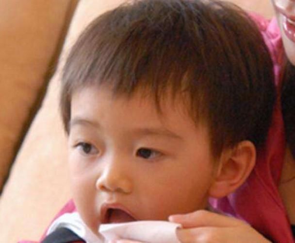 积食|孩子要有这4个变化,脾胃也许“烂如渔网”,家长尽量忽视