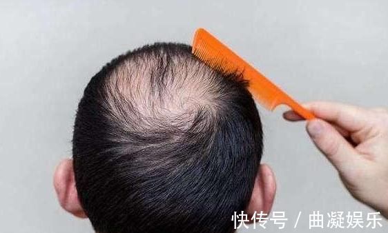 过度肥胖|男性开始衰老的4个丑态,若占3个以上,或许你是老了,别不服气!