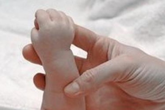 用力过猛|孩子三个月不会笑,奶奶却说是当领导的命,检查后医生却摇头