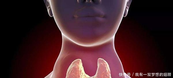 患有甲状腺结节怎么办平时少吃这3种食物,或能缓解病情!
