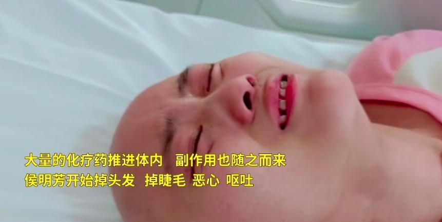 女孩|20岁漂亮女孩患癌对比图曝光,前后判若两人,父母皆是残疾人