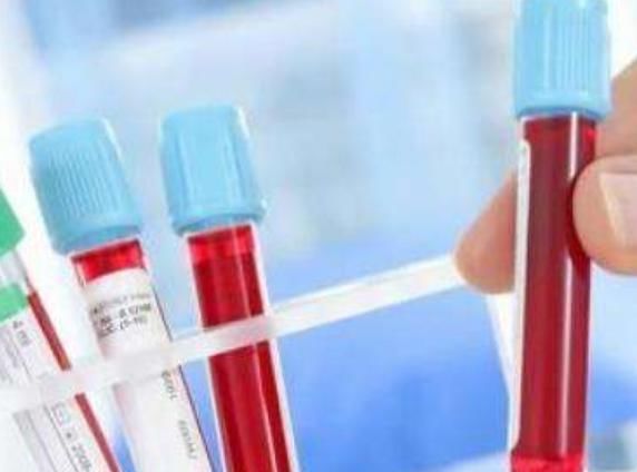 高血脂|血脂高怎么办？切记“3不吃，3吃”，别给胆固醇“飙升”的机会！