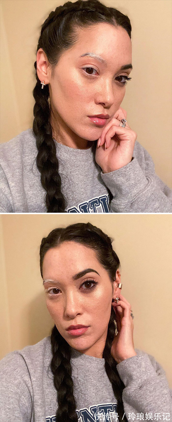 脚趾|19个“被上帝挑选过”的特殊基因人类,怎么梳都不整齐的头发