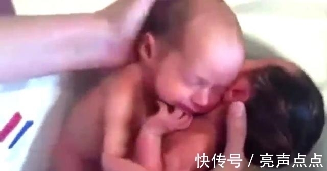 小家伙|双胞胎哥俩被剖腹抱出,哥哥以为有危险,一把将弟弟搂住!
