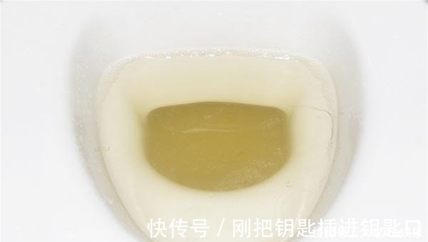 排出体外|小便时,尿液中有很多泡沫,味道还很重,是什么原因?