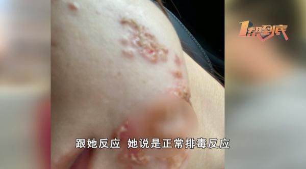 湘雅医院|海藻“焕肤”变“毁肤”，你却告诉我是因为熬夜导致“毁肤”？