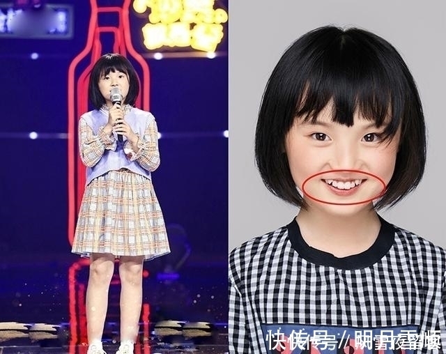 妈妈|17岁孩子长尖牙,妈妈以为是假的,亲手摸过后吐槽:像“吸血鬼”